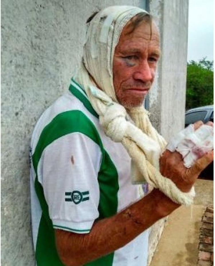 Idoso é espancado em Fronteiras (Foto: Portal Lagoa do Rato)